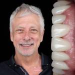 Smile Makeovers - Amazing Smiles Personalised treatment
