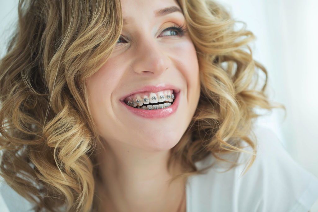 Taking Care Of Your Teeth With Metal Dental Braces