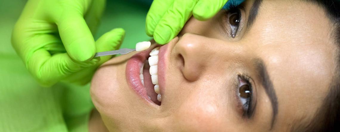 Should i get porcelain veneers or composite veneers?