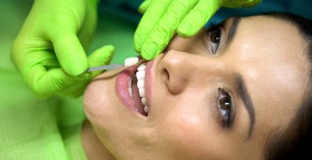 Should I get Porcelain Veneers or Composite Veneers?