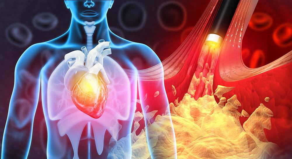 Cardiovascular Disease And Gum Health