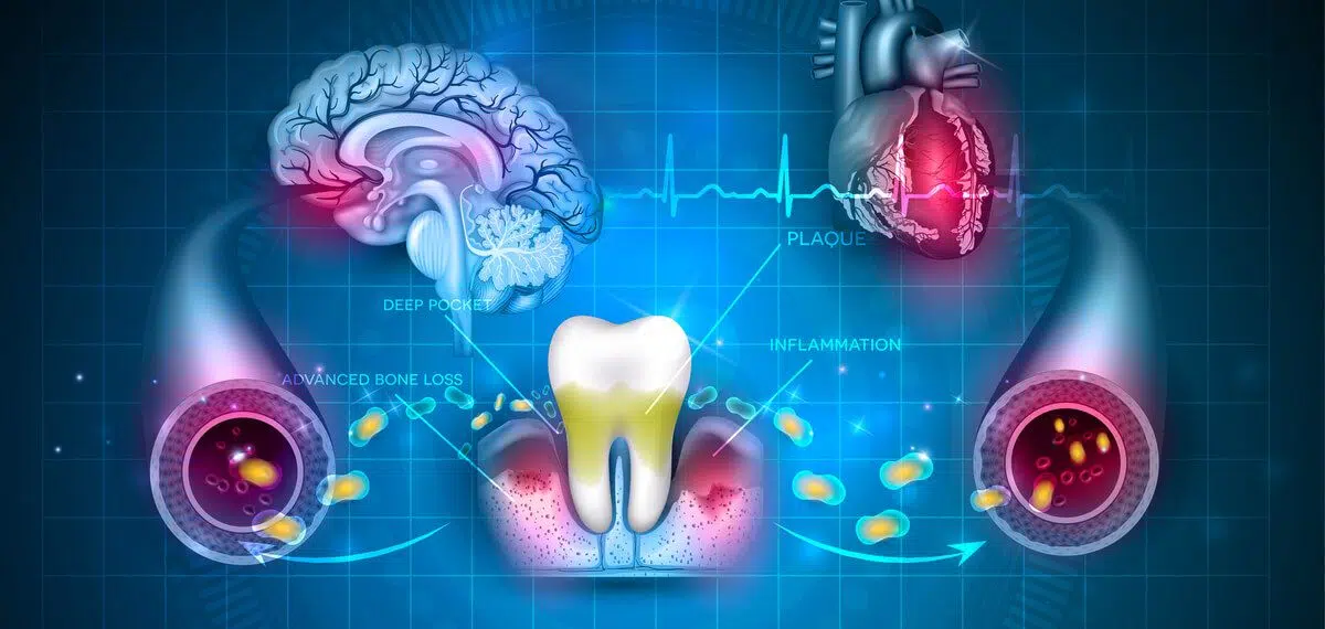 The Link Between Oral Health And Body's Well-Being