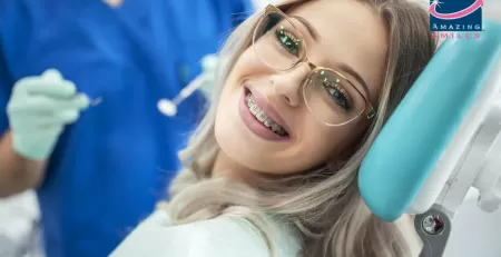 Benefits of Traditional Metal or Ceramic Braces