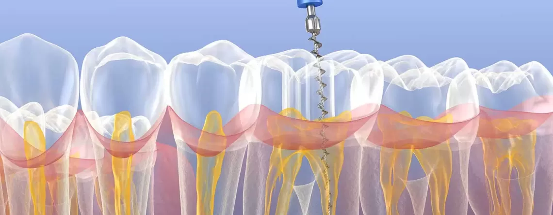 What Procedures Do Endodontists Perform