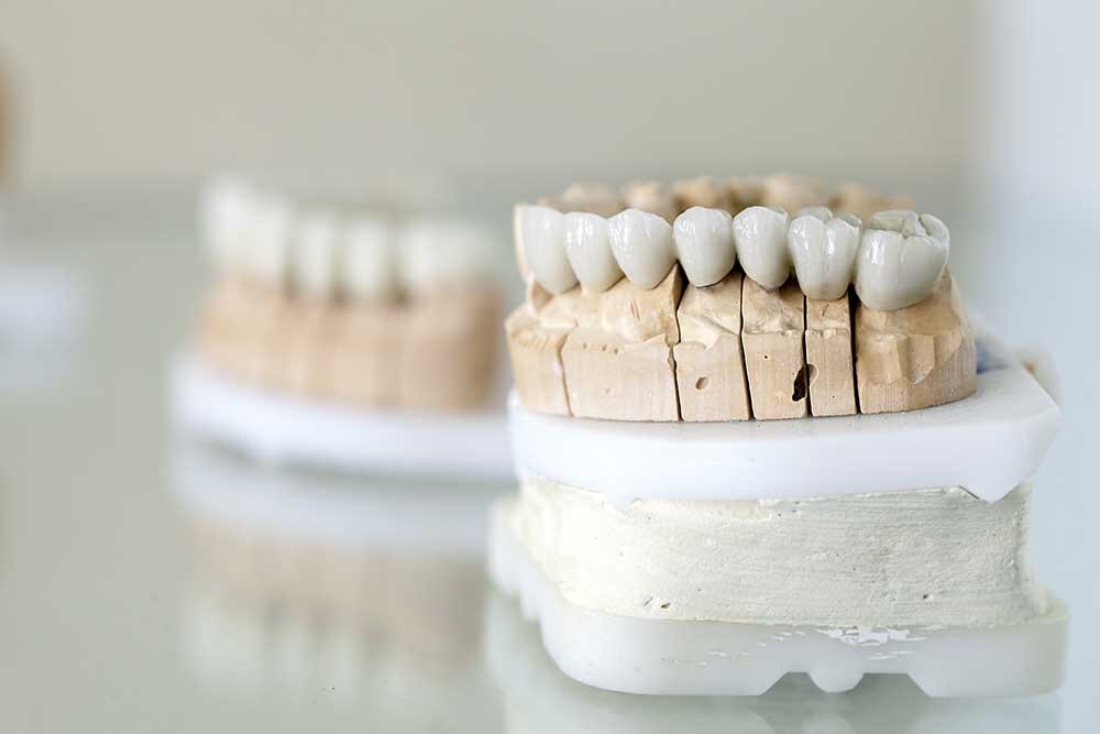 Restorative Dental