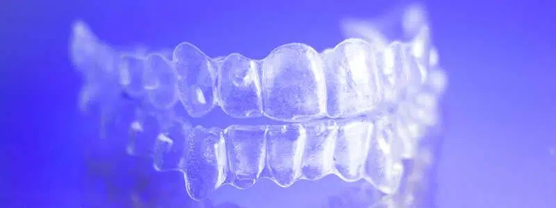 Clear Aligners