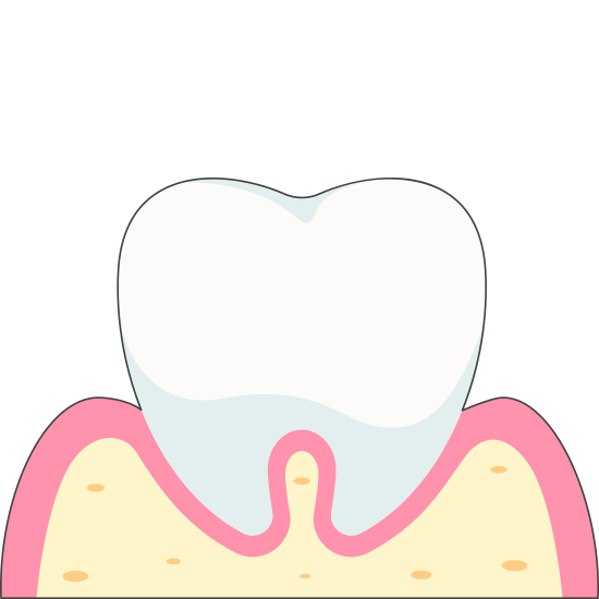 Normal Tooth