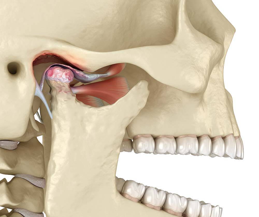 How dentists can help with TMJ (temporomandibular joint) disorders