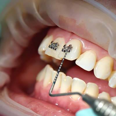 Orthodontic Referrals