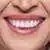 Overdenture