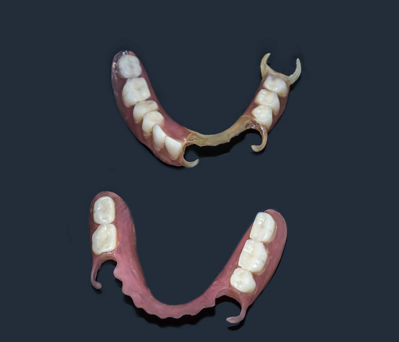 partial dentures gold coast - Amazing Smiles