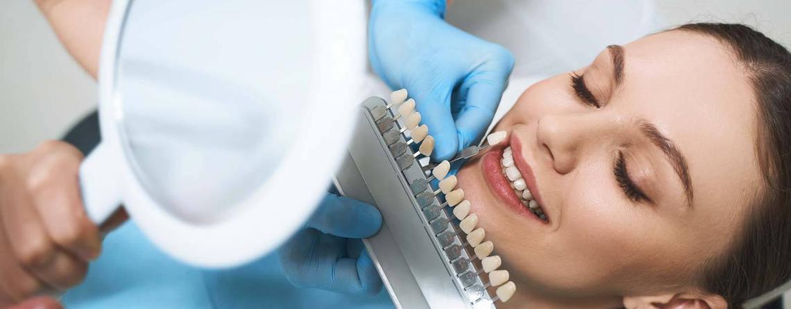 Complete Maintenance Guide To Porcelain Veneers Aftercare