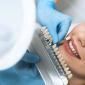 Complete Maintenance Guide to Porcelain Veneers Aftercare