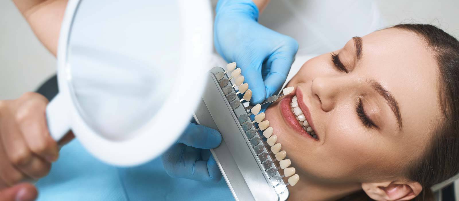 Complete Maintenance Guide to Porcelain Veneers Aftercare