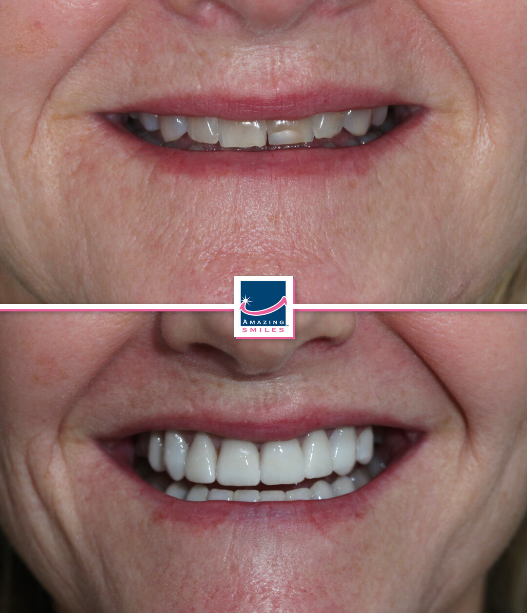 Nerang Dental Case - Before And After