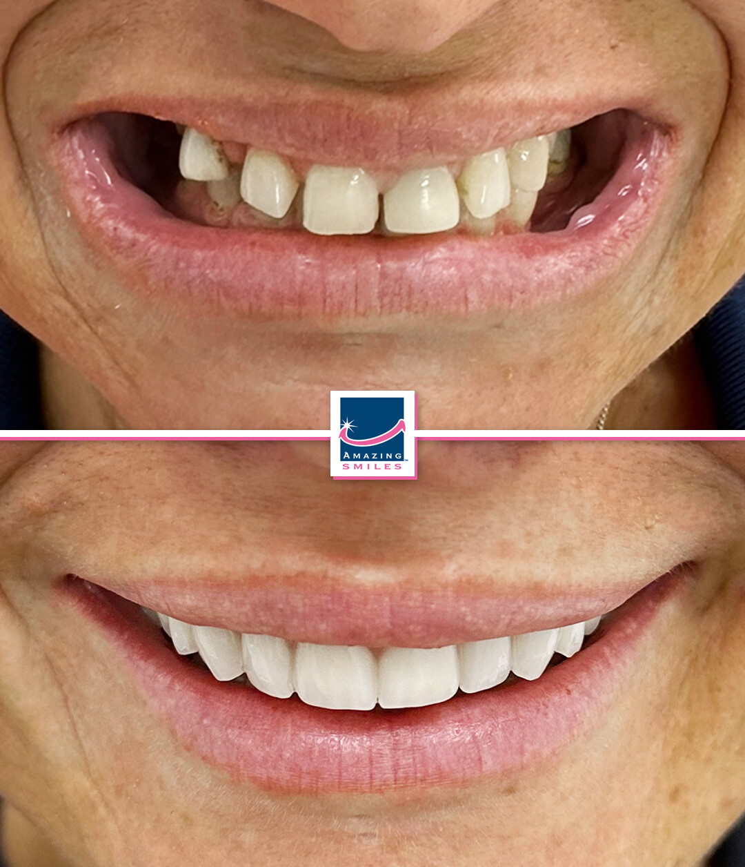 Nerang Dental Case - Before And After