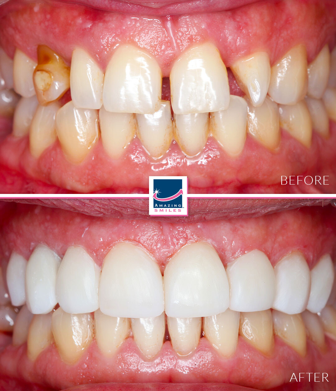 Nerang Dental Case - Before And After