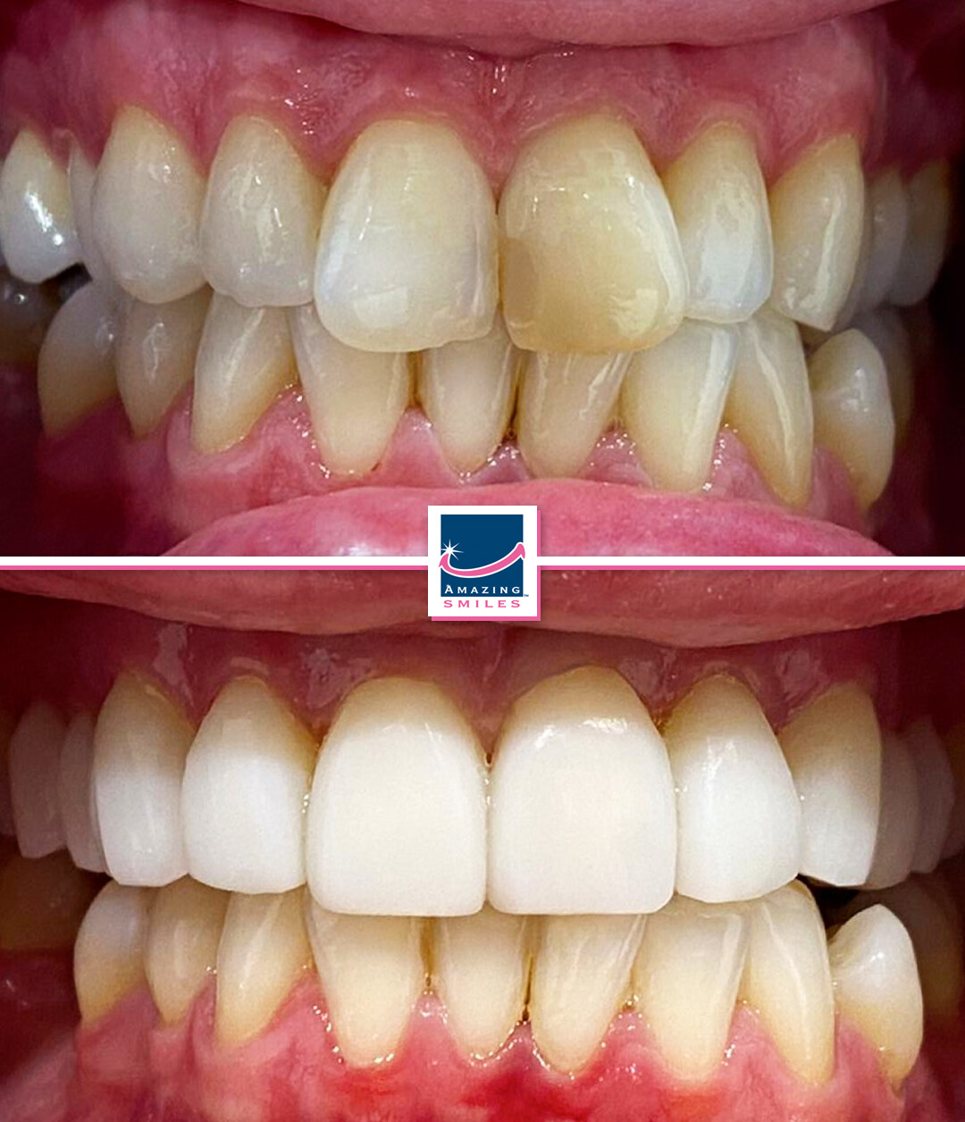 Nerang Dental Case - Before And After