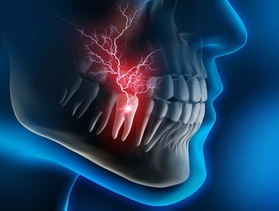 Understanding the Connection of Tooth Infection Spreading Throughout the Body