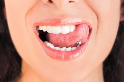 Understanding the Risks and The Impact of Oral Piercing on Oral Health