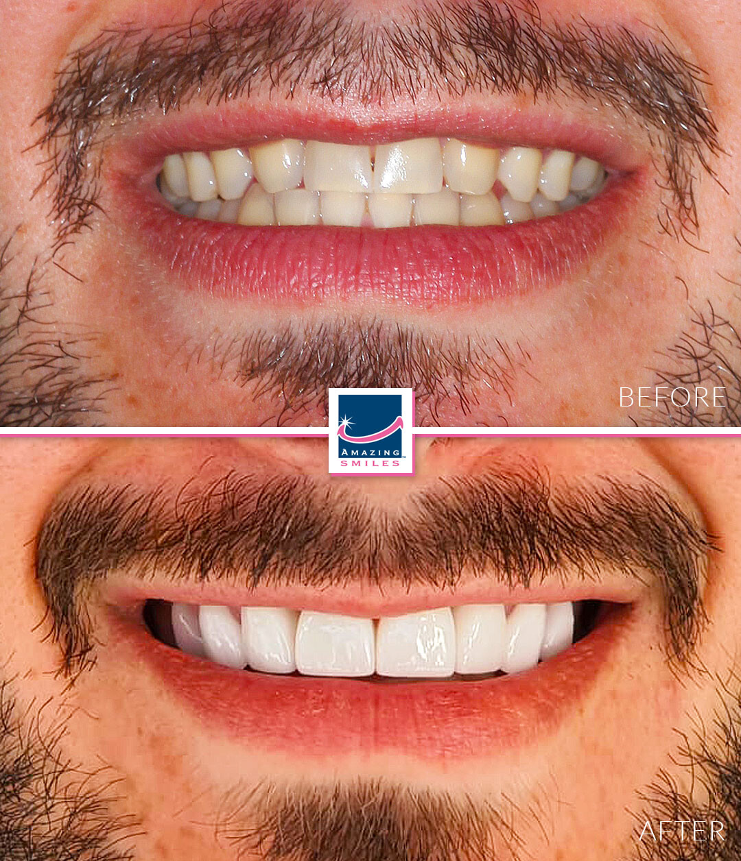 Nerang Dental Case - Before And After