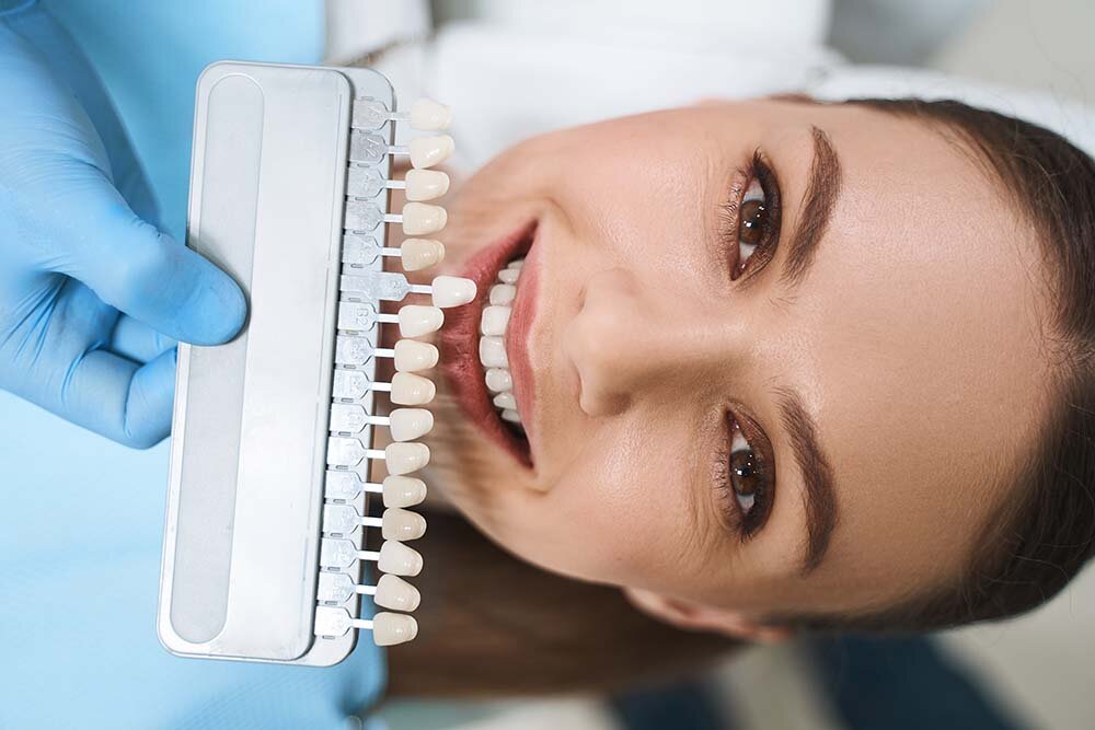 Complete Aftercare Guide For Composite Veneers