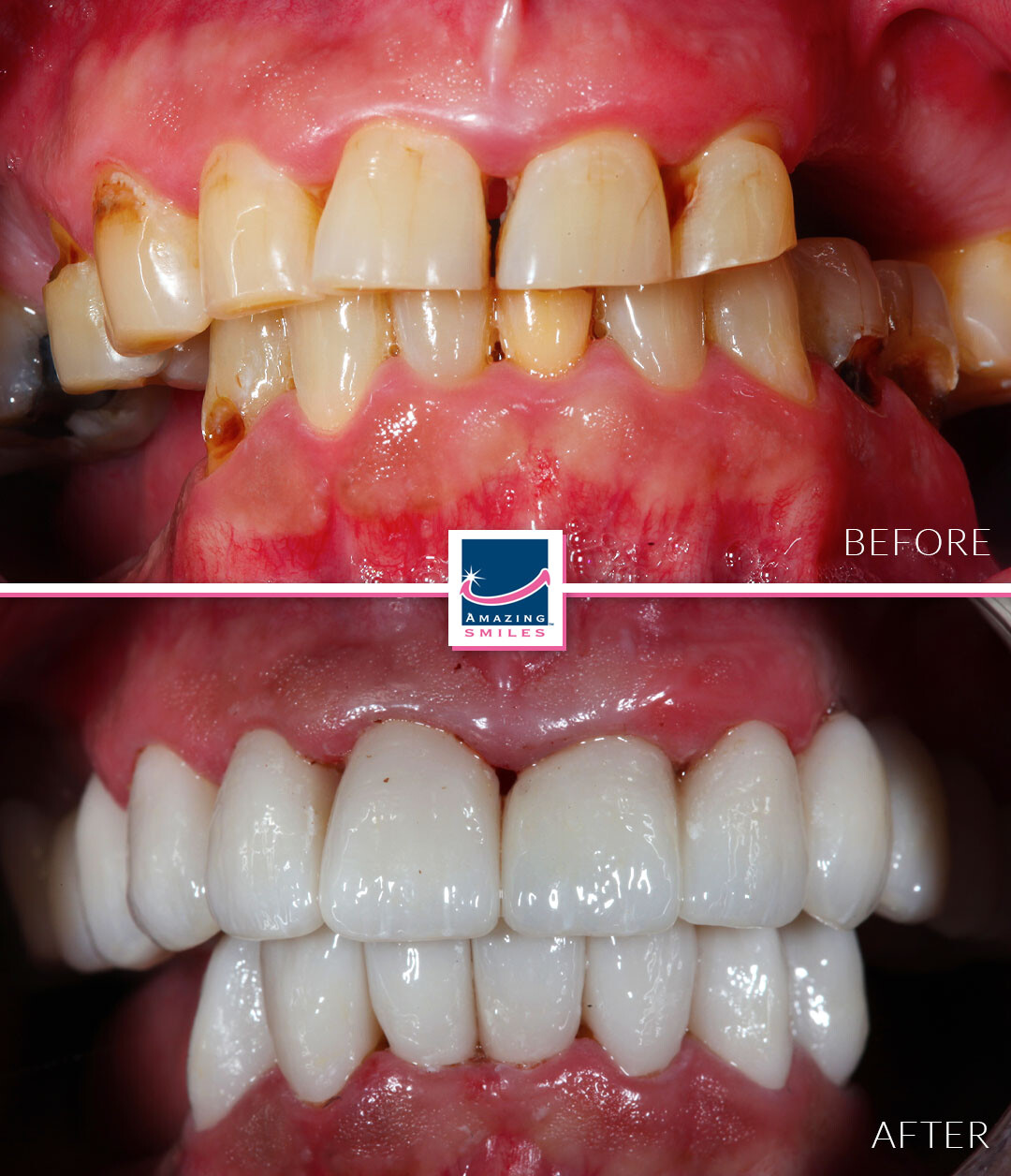 Dentist Gold Coast - Before And After