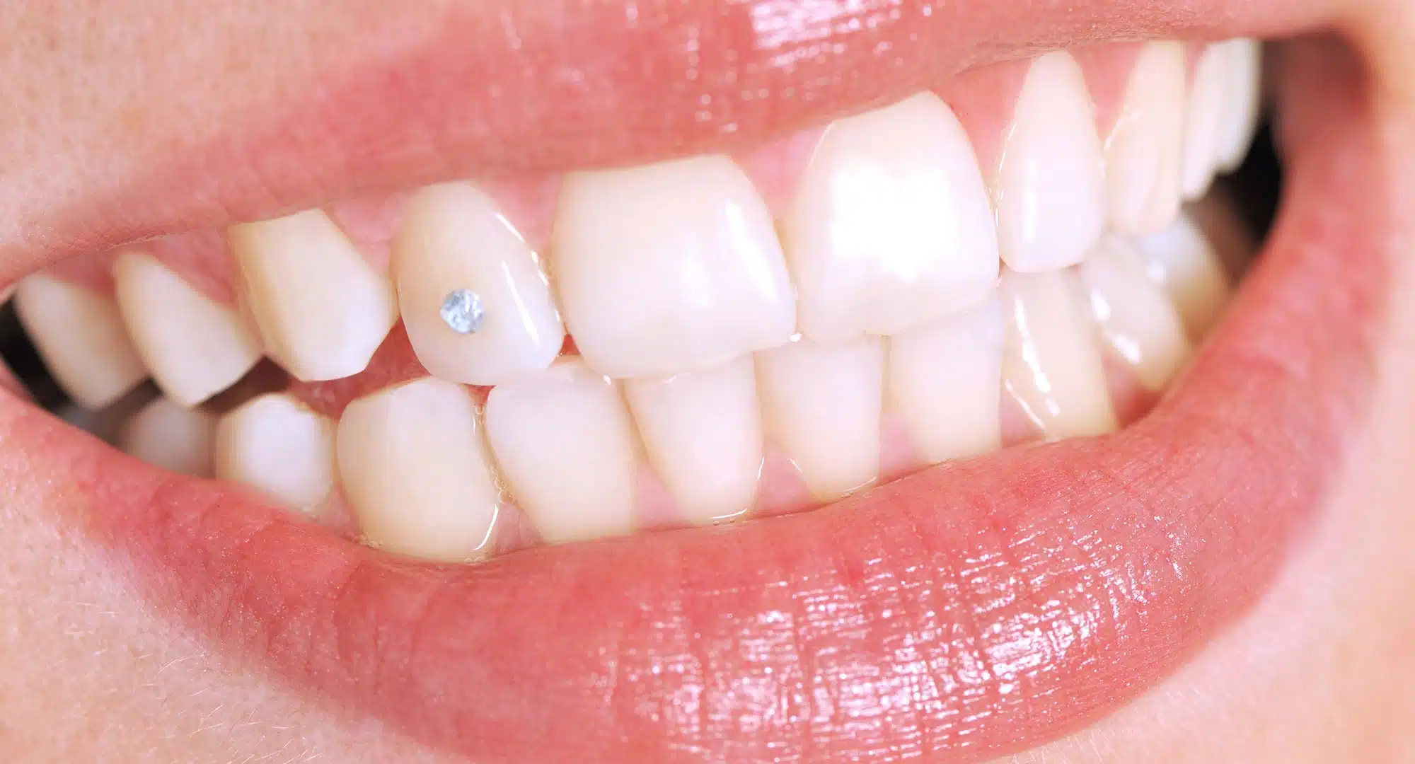 Dental Gems - Tooth Gems Jewellery - Shine Your Smile