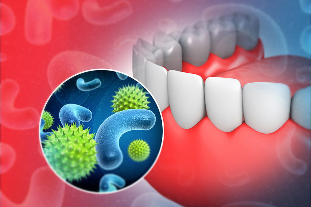 Functions Of The Oral Microbiome - Amazing Smiles Gold Coast Dentist