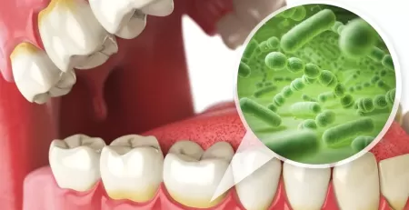 What is Oral Microbiome? - Amazing Smiles Family Dentist Gold Coast