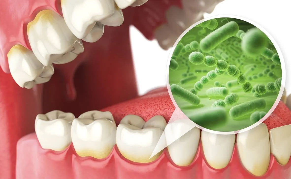 What is Oral Microbiome? - Amazing Smiles Family Dentist Gold Coast