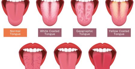 Deciphering Health Clues from Your Tongue