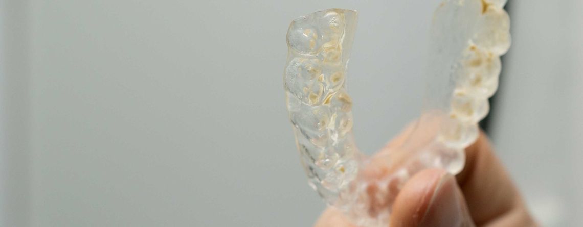 Clean Aligners and Retainers to Prevent Bacterial Build-Up