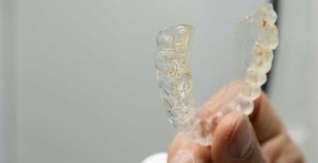 Clean Aligners and Retainers to Prevent Bacterial Build-Up