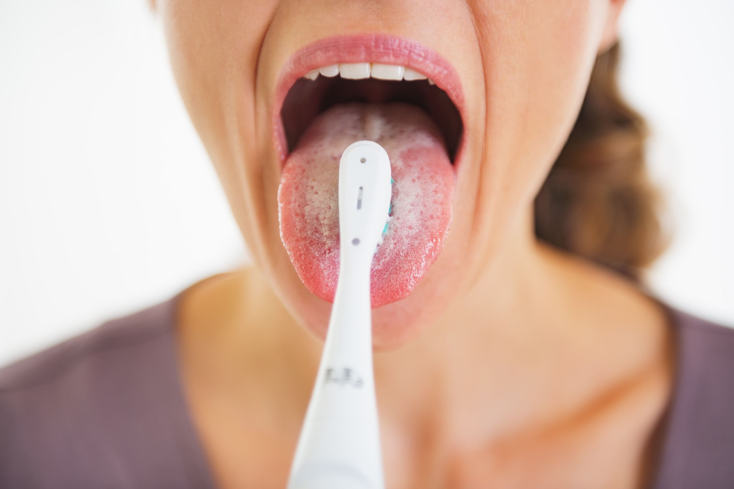 Cleaning Your Tongue Prevents Oral Infections And Diseases