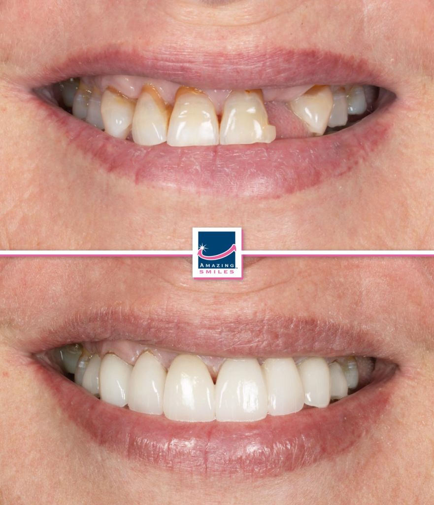 best cosmetic dentist gold coast