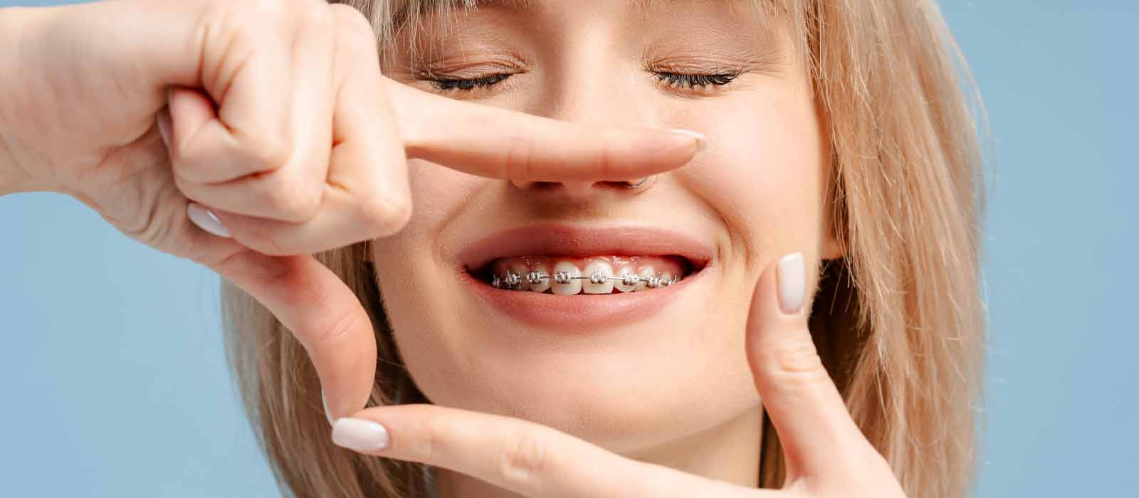 affordable orthodontics gold coast dental braces
