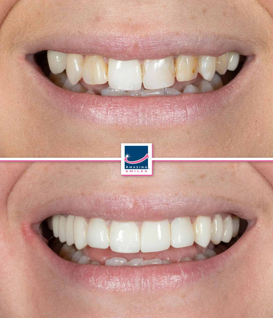 Dentist Jimboomba - Amazing Smiles Cosmetic dentist jimboomba