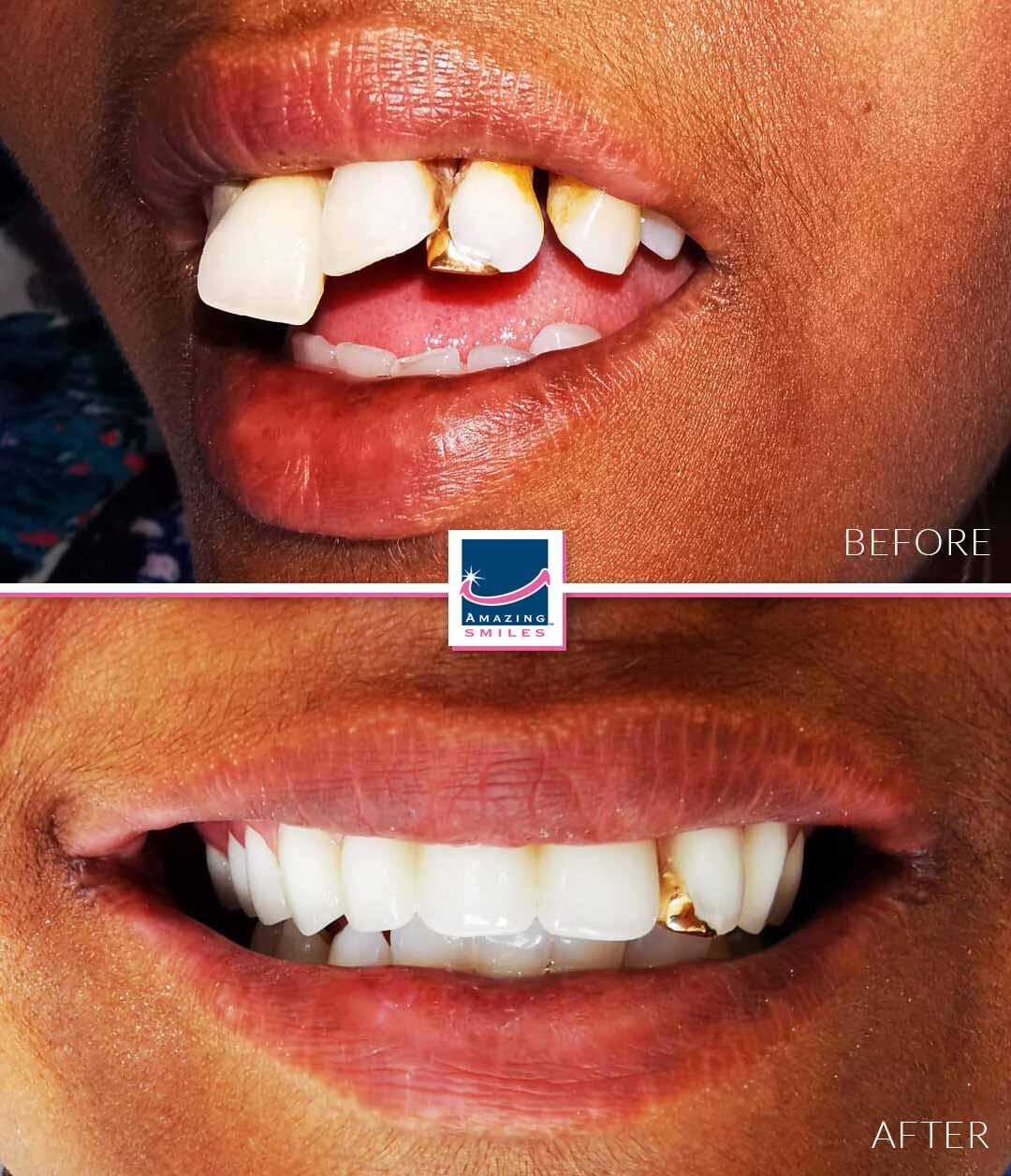 Dentist Logan - Amazing Smiles Logan cosmetic dentist near me