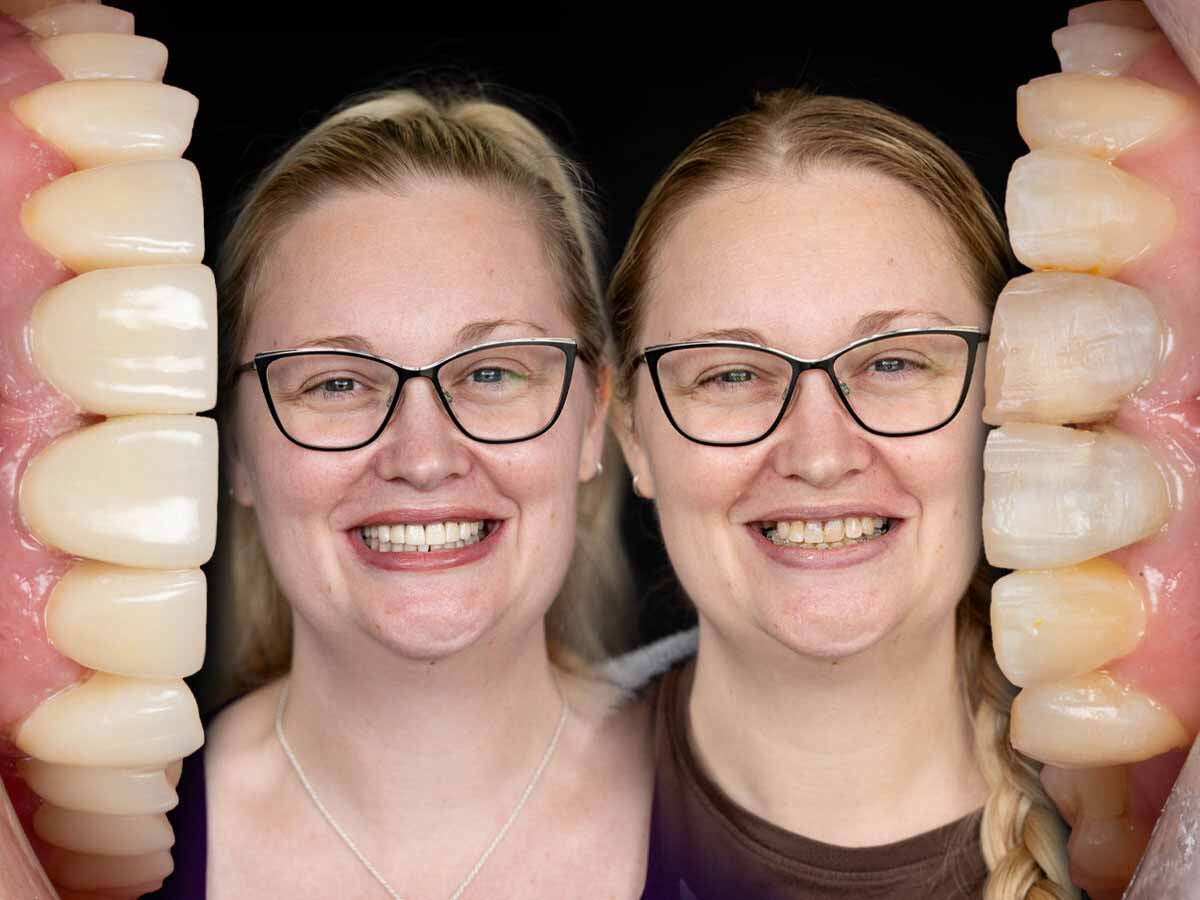 Nearest Dentist For Orthodontics Bray Park Nearest dentist for orthodontics bray park