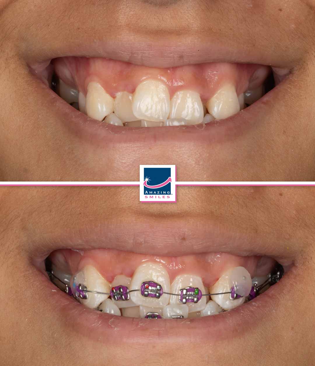 Dentist Logan - Amazing Smiles Orthodontics logan