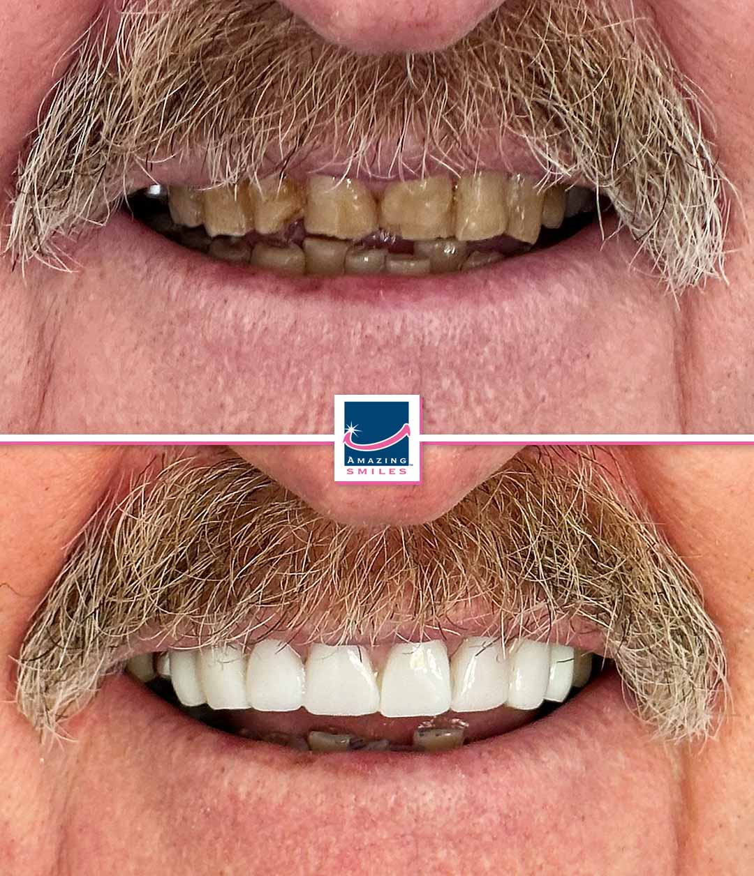 Dentist Logan - Amazing Smiles Smile makeover logan