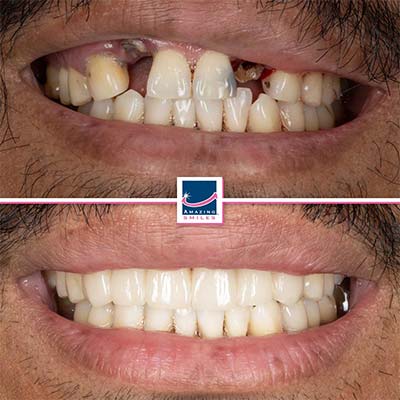 Dentist gold coast - amazing smiles