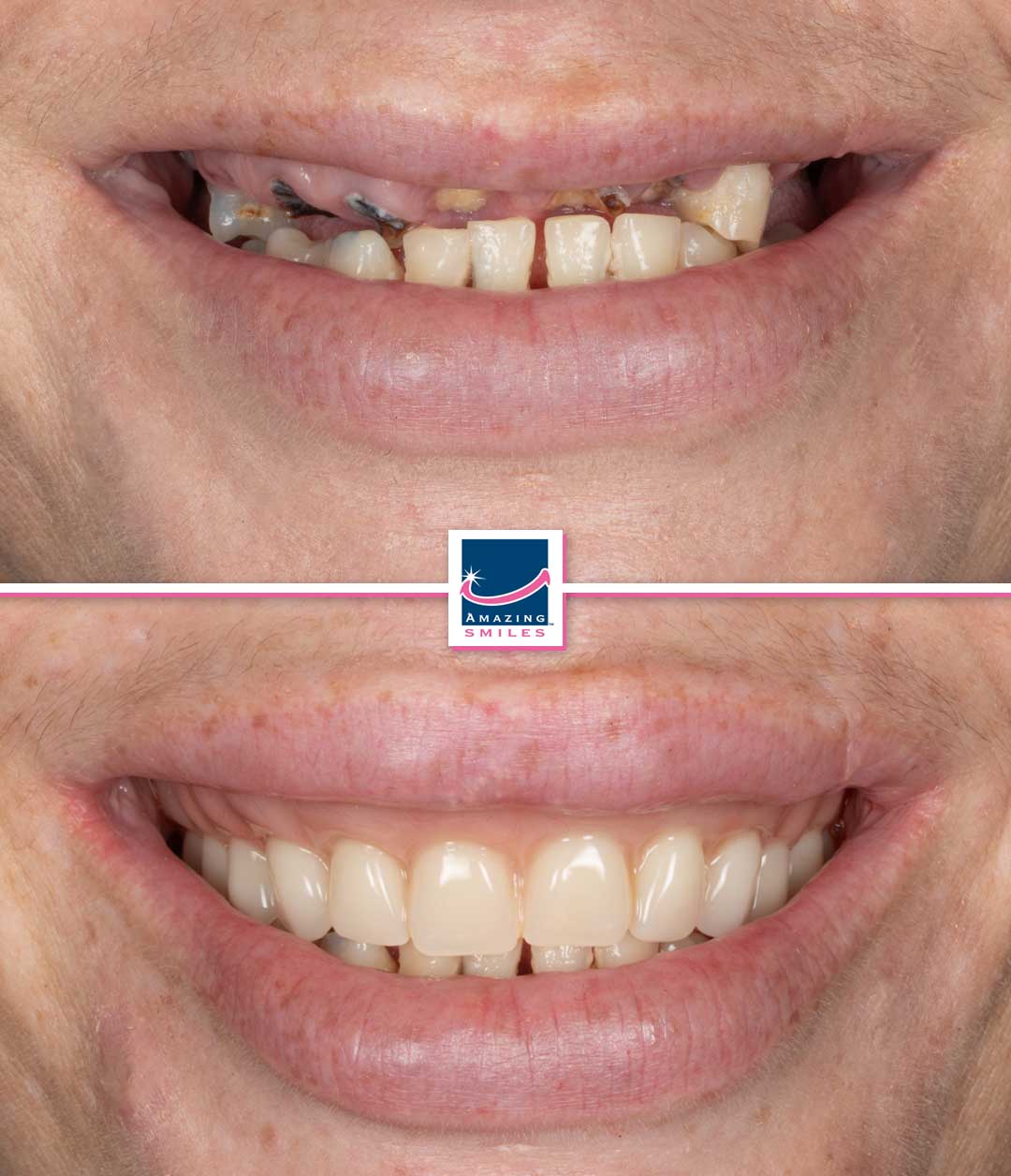 Dentist gold coast - amazing smiles